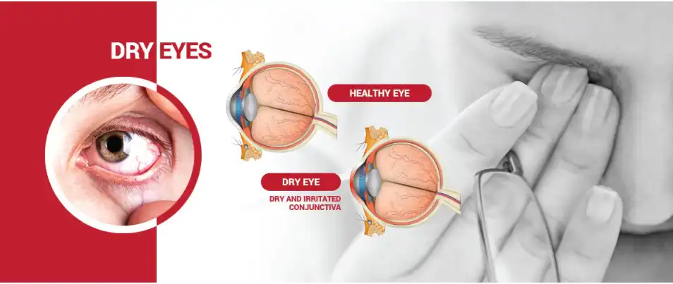 Astaxanthin Powder for Eye Care Astaxanthin Powder for Eye Care